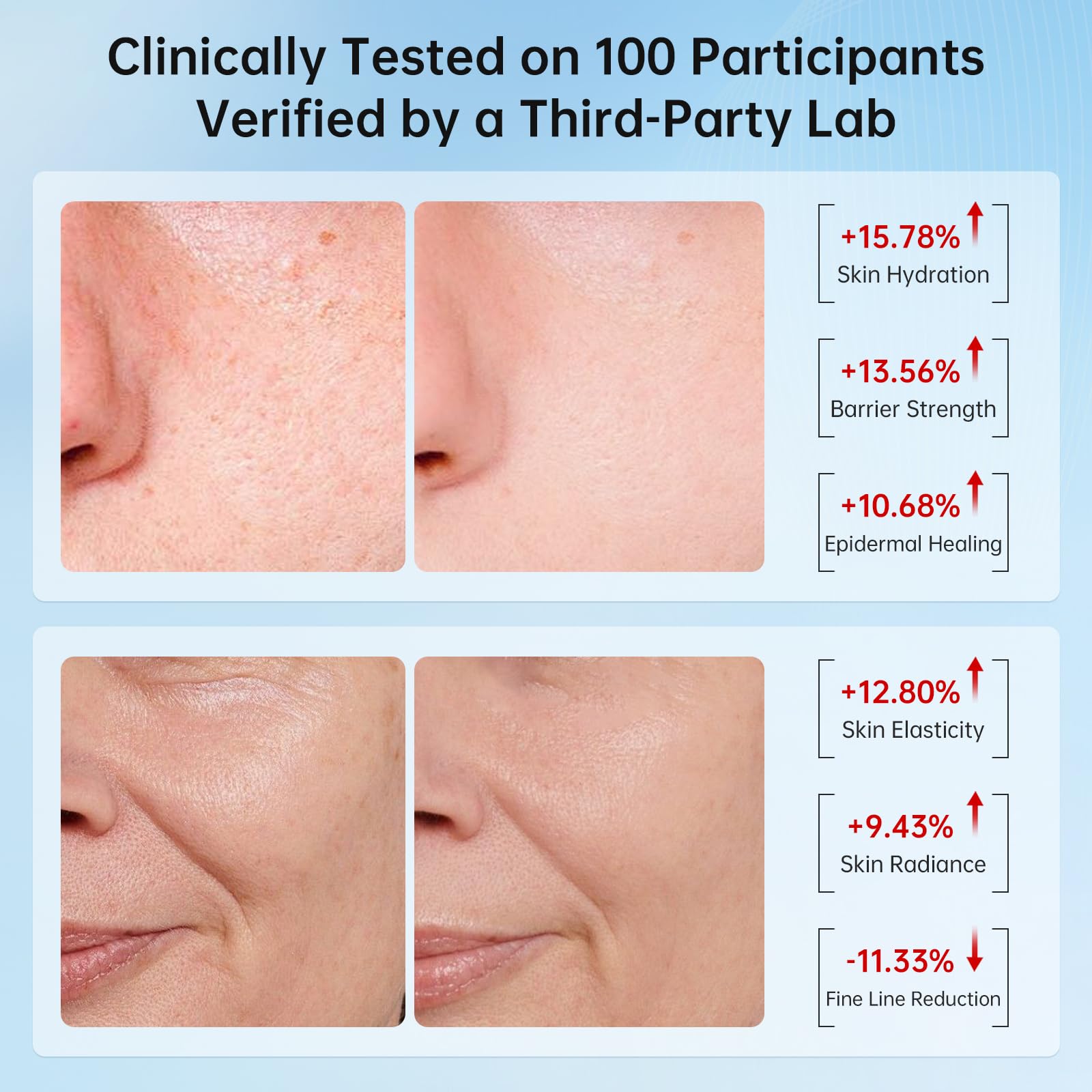 VGO Snail Mucin 92% Face Moisturizer – Anti Aging, Skin Repair & Hydrating Face Cream with Ceramide & Vitamin E, 1.76 oz